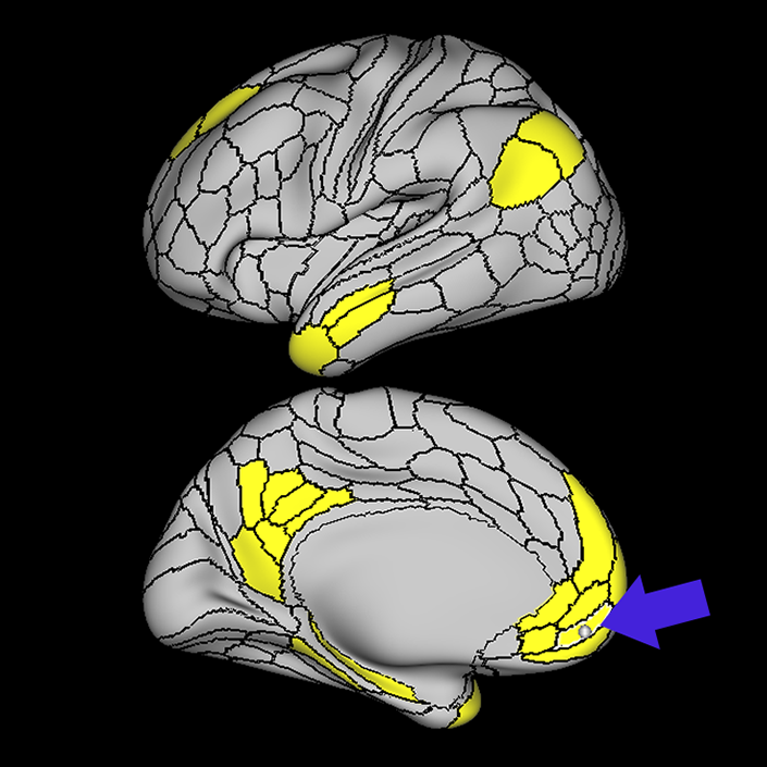 10r_a