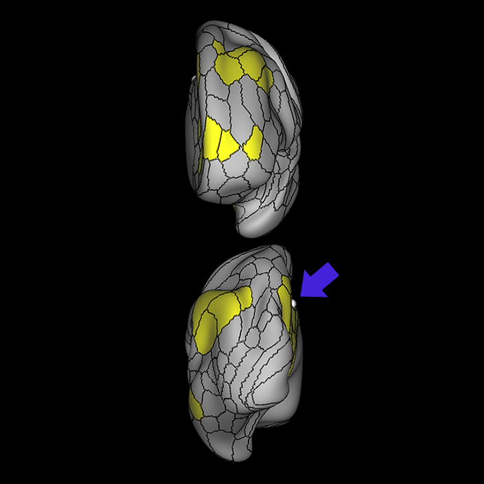 31a_b
