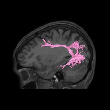 Visual System - Connectome Guide